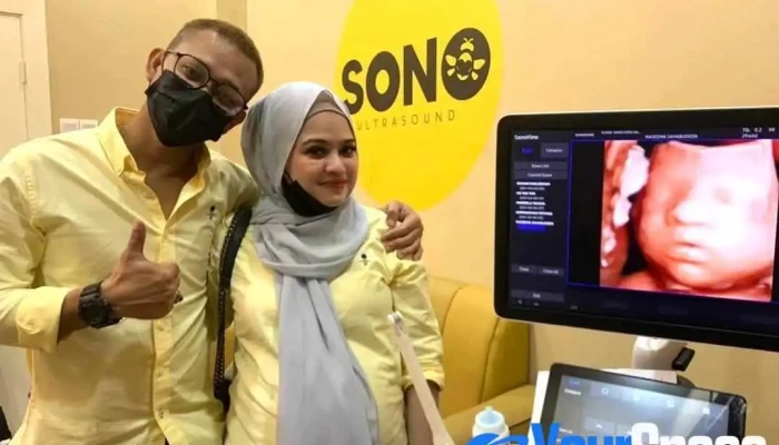 Sonobee Ultrasound Wakaf Bharu - Jalan Puteri Saadong