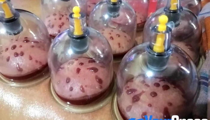 Urut Bekam Regangan Tulang Refleksologi Sabak Bernam Terapi Assalam Oleh Pemilik - Sungai Besar